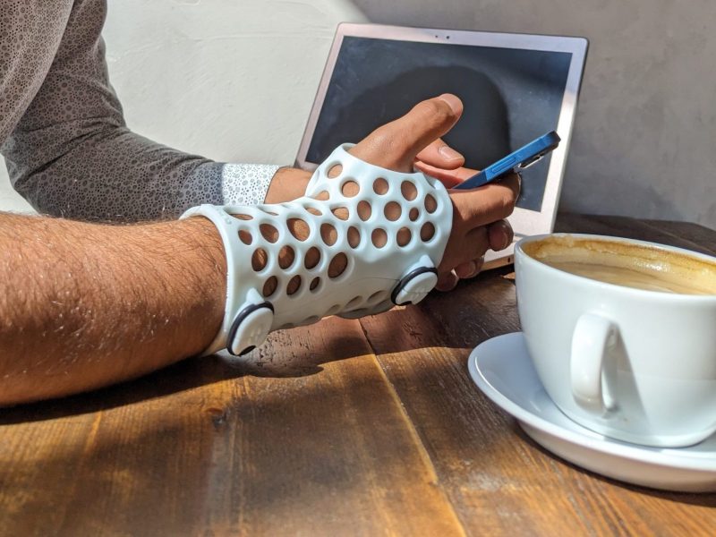 A person wearing a 3D printed cast from CAST3D while in a meeting.